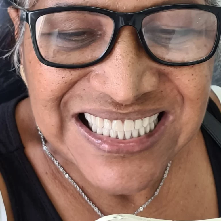 prótese sup e protocolo inf 4