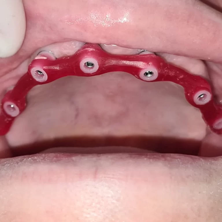 protocolo superior 1